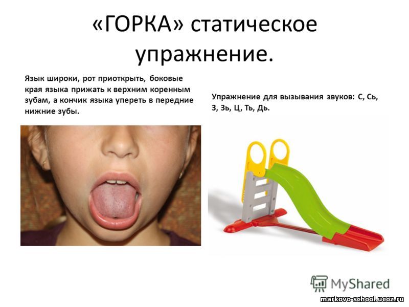 Артикуляционное упражнение «Горка»