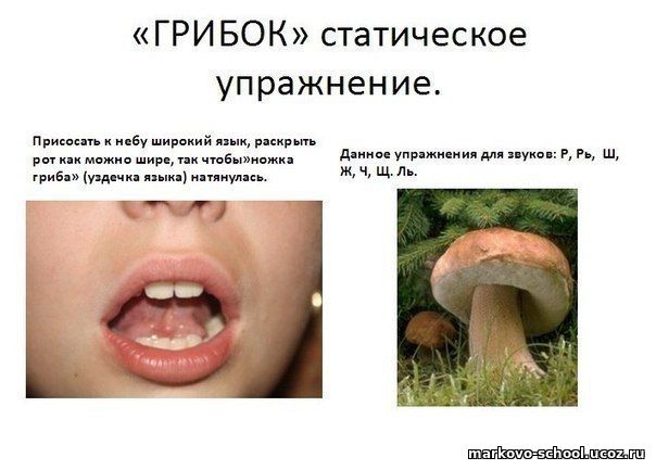 Артикуляционное упражнение «Грибок»