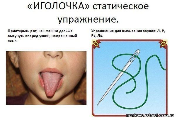 Артикуляционное упражнение «Иголочка»